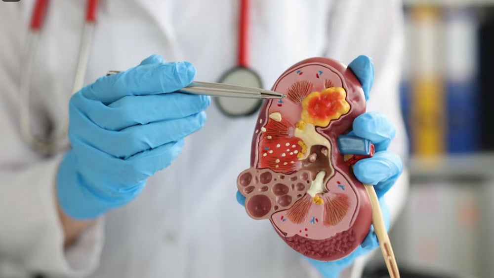 kidney failure causes